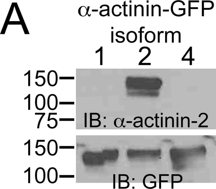 Anti-Sarcomeric Alpha Actinin antibody [EP2529Y](AB68167)