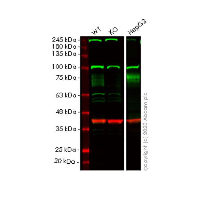 Anti-IFNGR1 antibody [EPR7866](AB134070)