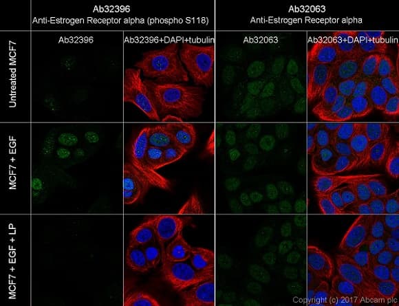 Estrogen Receptor Alpha Phospho S118 Antibody E91 Ab32396  Immunocytochemistry Immunofluorescence Img120137