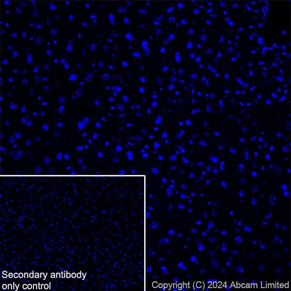 Anti-Prosurfactant Protein C antibody [RM1264](AB322443)