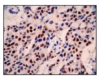Anti-Estrogen Receptor alpha antibody [E115] - ChIP Grade(ab32063)