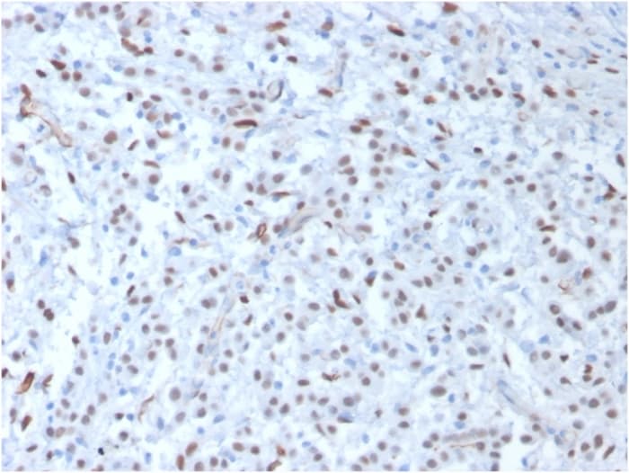 Anti-Wilms Tumor Protein antibody [WT1/857](AB220212)
