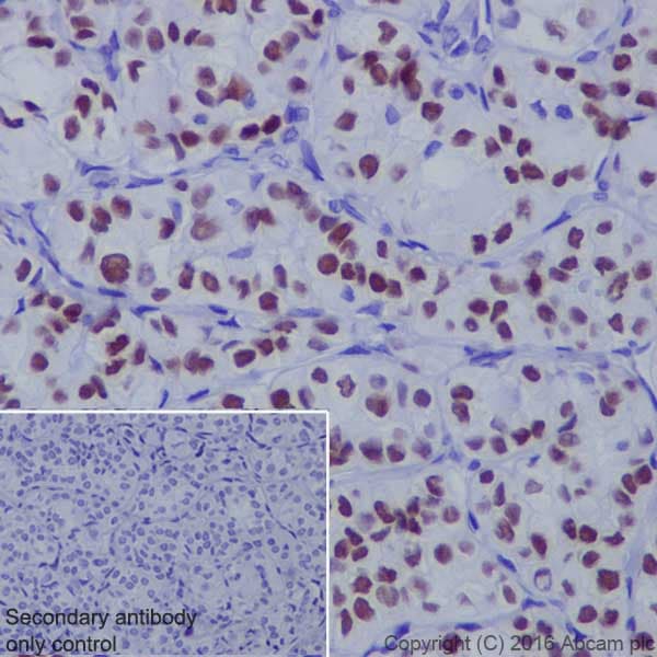 Anti-TTF1/Nkx2-1 antibody [EP1584Y](AB76013)