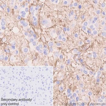 Anti-Glutamine Synthetase antibody [EPR13022(B)](AB176562)