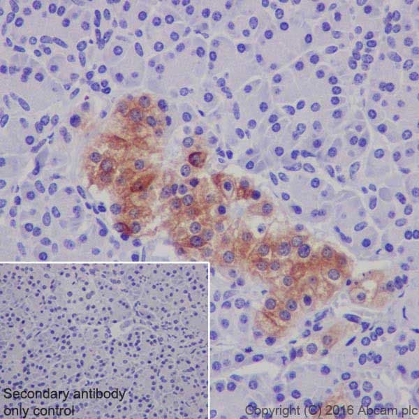 Anti-MAP2 antibody [EPR19691](AB183830)