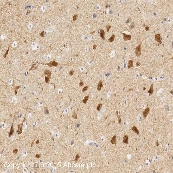 Synaptic Marker (Synaptophysin, Synapsin1, PSD95, VAMP2) Antibody Sampler Panel - Human, Mouse(AB263463)