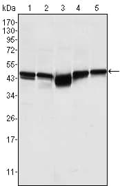 Anti-GSK3 beta antibody [3D10](AB93926)