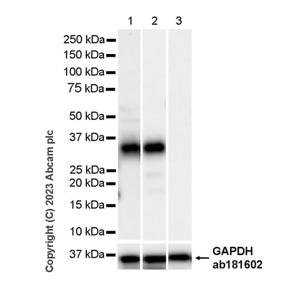 Anti-Neutrophil Elastase antibody [RM1077](AB314916)