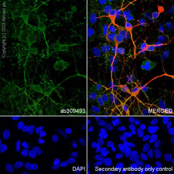 Anti-MAP2 antibody [EPR19691](AB183830)