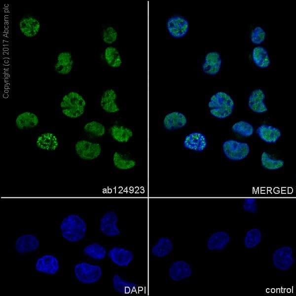 Tls Fus Antibody Epr5812 Ab124923  Immunocytochemistry Immunofluorescence Img49072