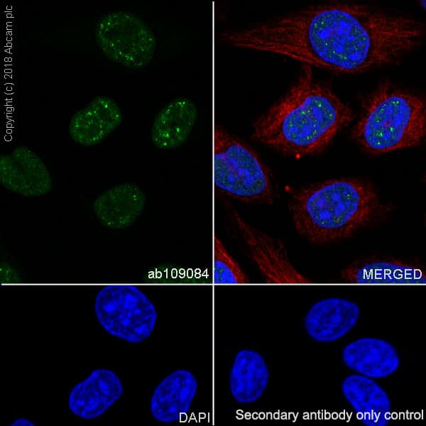 Anti-RPA32/RPA2 antibody [EPR2876(2)](AB109084)
