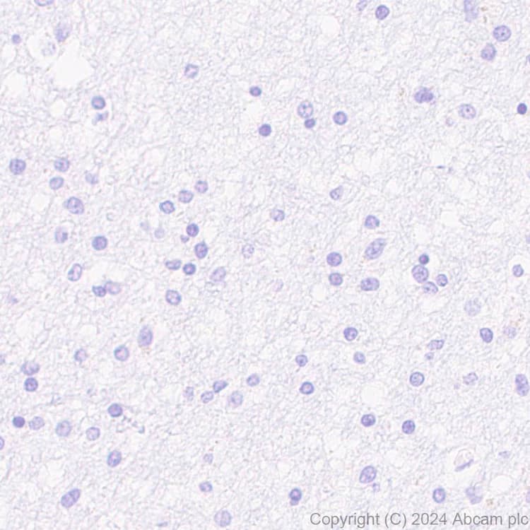 Anti-Pseudomonas Outer membrane porin F antibody [EPR28629-91](AB316973)