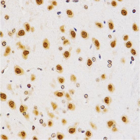 Anti-Histone H4 (asymmetric di methyl R3) antibody(AB194683)