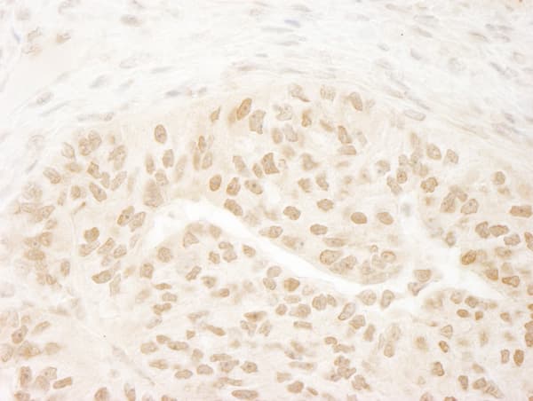 Kmt4 Dot1l Antibody Ab72454  Immunohistochemistry Formalin Pfa Fixed Paraffin Embedded Sections Img132969