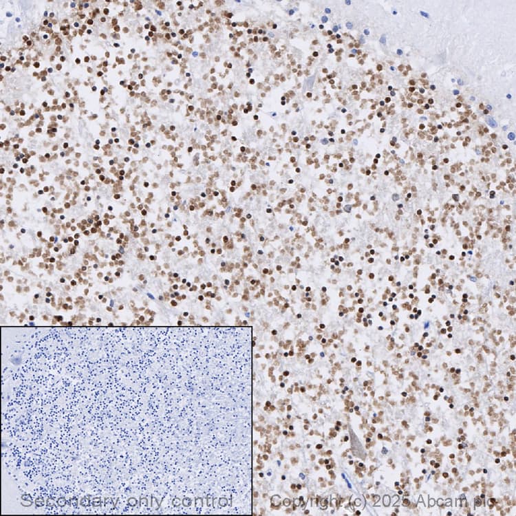 Anti-PAX6 antibody [EPR15858](AB195045)