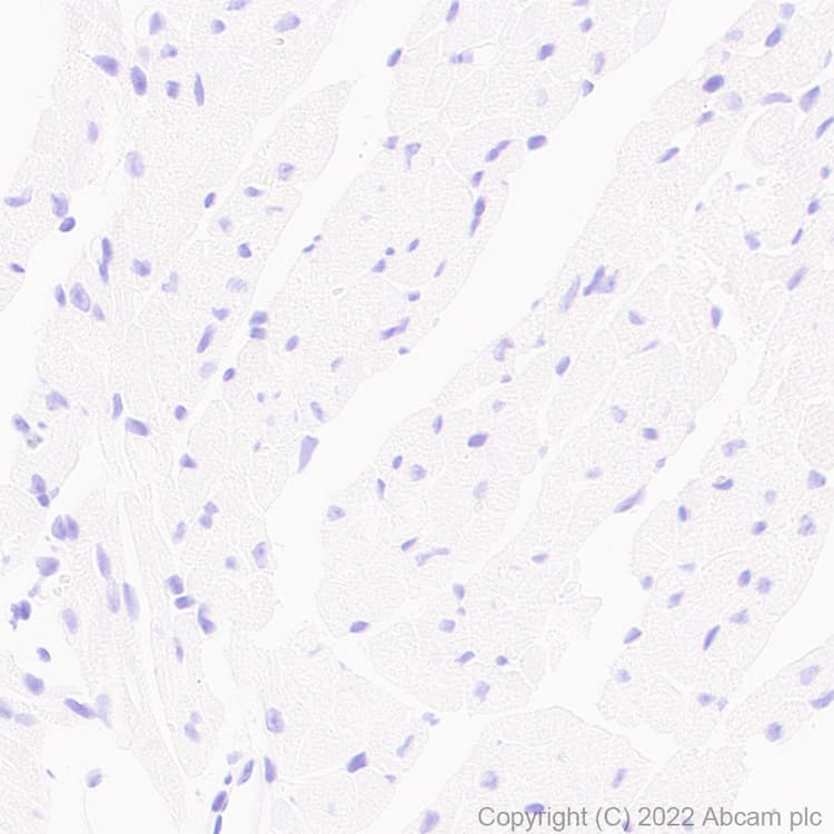 Anti-ABCA4 antibody [EPR26543-66](AB303504)