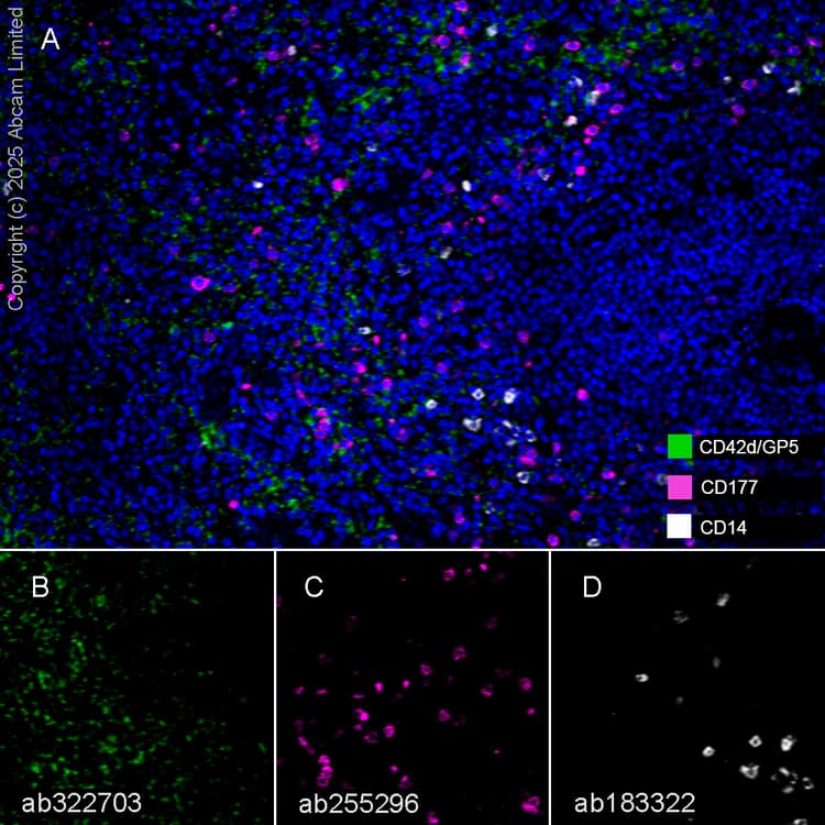 Anti-CD14 antibody [SP192](AB183322)