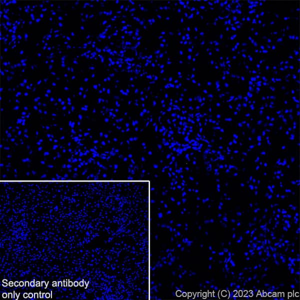 Anti-RS1 antibody [EPR28513-78](AB314231)