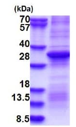 Recombinant Human Prothrombin protein (denatured)(AB180268)