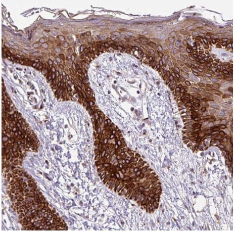 Msmp Antibody Ab185471  Immunohistochemistry Formalin Pfa Fixed Paraffin Embedded Sections Img7625