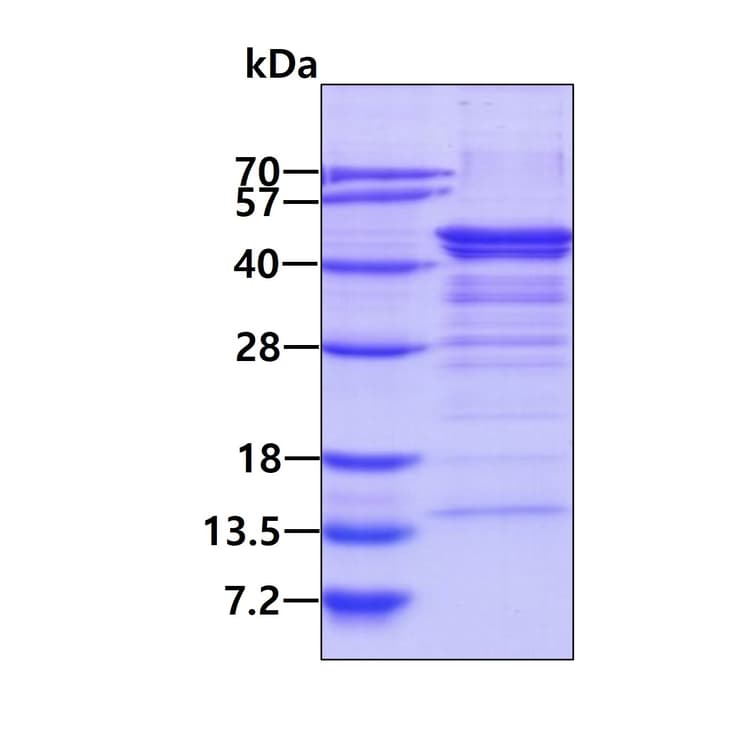 Recombinant Human NDEL1 protein(AB183232)