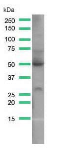 Anti-Glucose Transporter GLUT1 antibody [SP168](AB150299)