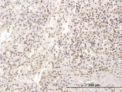 Anti-SP100 antibody(AB167605)