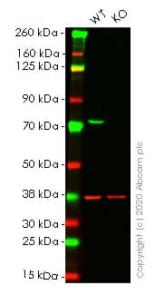 Tls Fus Antibody Epr5812 Ab124923  Western Blot Img56082