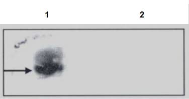 Anti-N6-methyladenosine (m6A) antibody [17-3-4-1](AB208577)