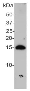 Anti-Alpha-synuclein antibody(AB190376)