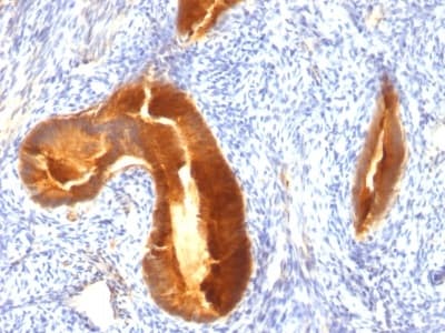 Anti-MUC1 antibody [MUC1/955](AB233933)