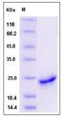 Recombinant human Shh protein (His tag)(AB276262)