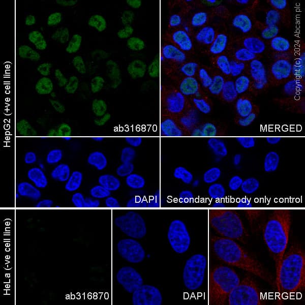 Hnf1 Alpha Antibody Rm1094 Bsa And Azide Free Ab316871  Immunocytochemistry Immunofluorescence Img428300