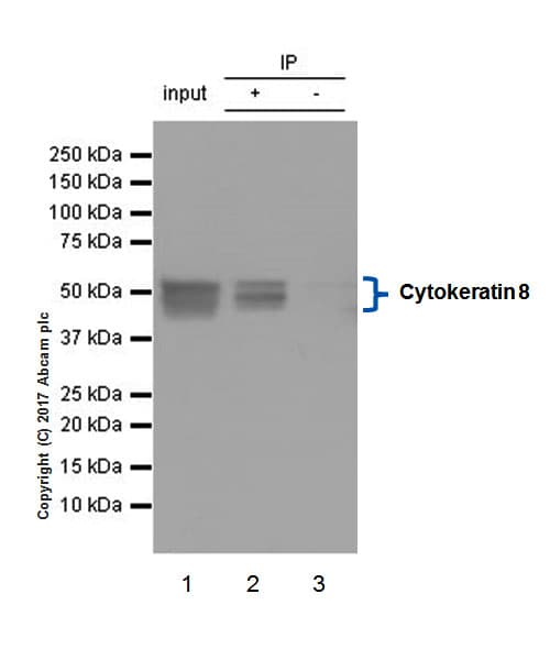 Anti-Cytokeratin 8 antibody [EP1628Y] - Cytoskeleton Marker(AB53280)