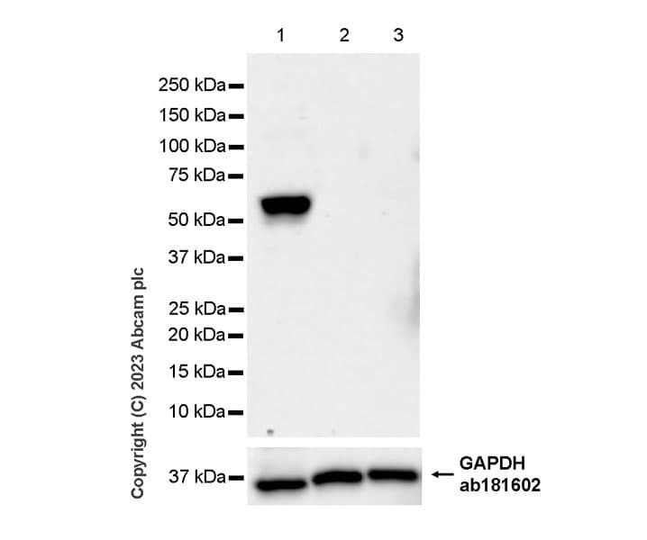Anti-Tyrosine Hydroxylase antibody [RM1085](AB315252)