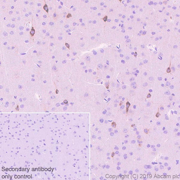 Anti-Reelin antibody [EPR22515-75](AB230820)
