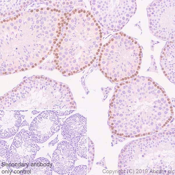 Anti-DMC1 antibody [EPR23207-130](AB245217)