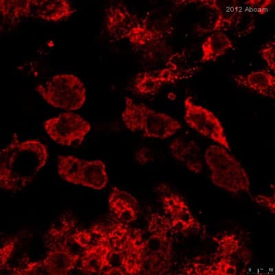 Anti-Calreticulin antibody - ER Marker(AB2907)