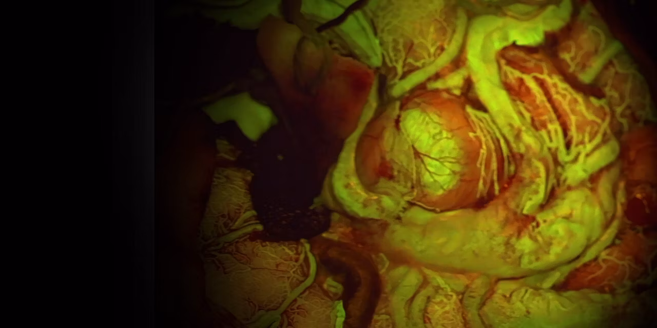 Intraoperative Fluorescence Fls560 Stage Kid21765314
