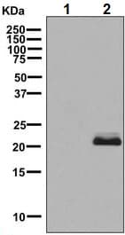 Anti-SOD2/MnSOD (acetyl K68) antibody [EPVANR2](AB137037)