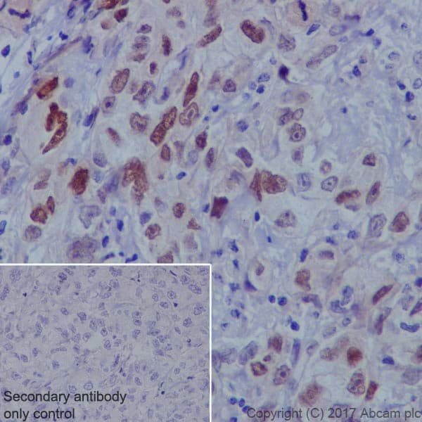 Anti-FOXC1 antibody [EPR20685](ab227977)