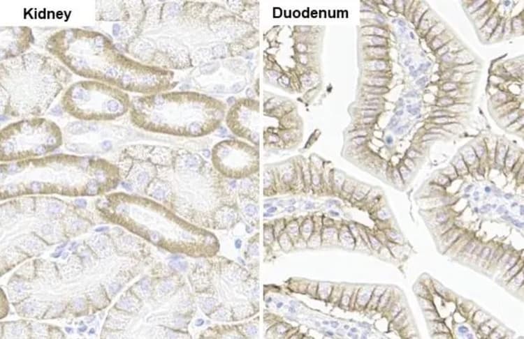Anti-Sodium Potassium ATPase alpha 1 antibody [HL114](ab308329)