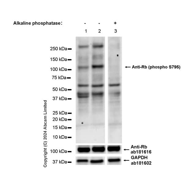 Anti-Rb antibody [EPR17512](AB181616)