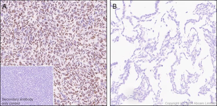 Dnmt1 Antibody Rm1192 Ab317845  Immunohistochemistry Formalin Pfa Fixed Paraffin Embedded Sections Img434467