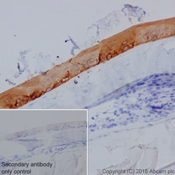Anti-Keratin 12/K12 antibody [EPR17882] - BSA and Azide free(AB240295)