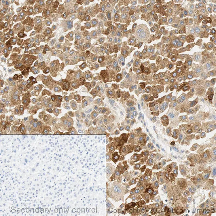 Anti-FACL4 antibody [EPR8640](AB155282)