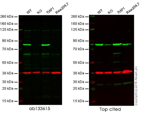Anti-Calnexin antibody [EPR3633(2)] - ER Membrane Marker(AB133615)