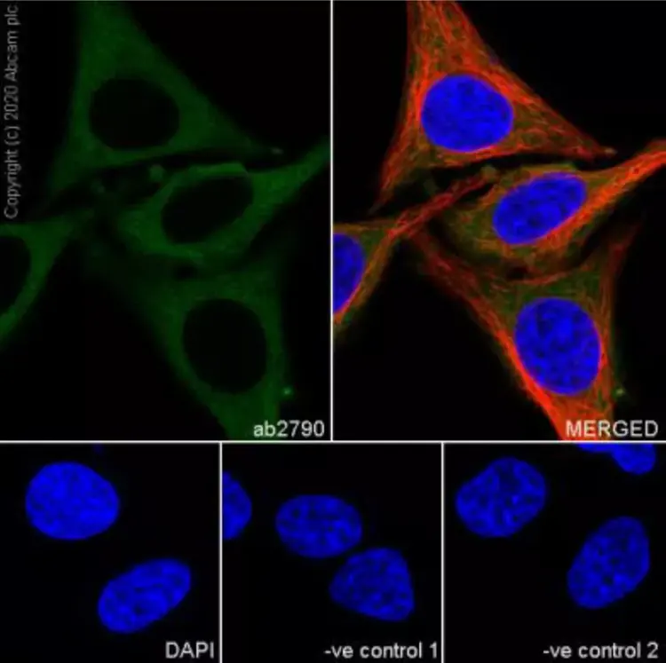 Goat Anti-Rabbit IgG H&L (Alexa Fluor® 594)(AB150080)