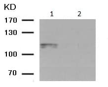Anti-alpha 1 Sodium Potassium ATPase (phospho S16) antibody(AB194532)