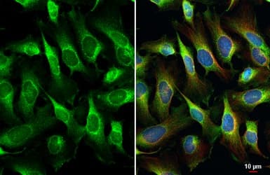 Npepps Antibody Hl1531 Ab308163  Immunocytochemistry Immunofluorescence Img407058